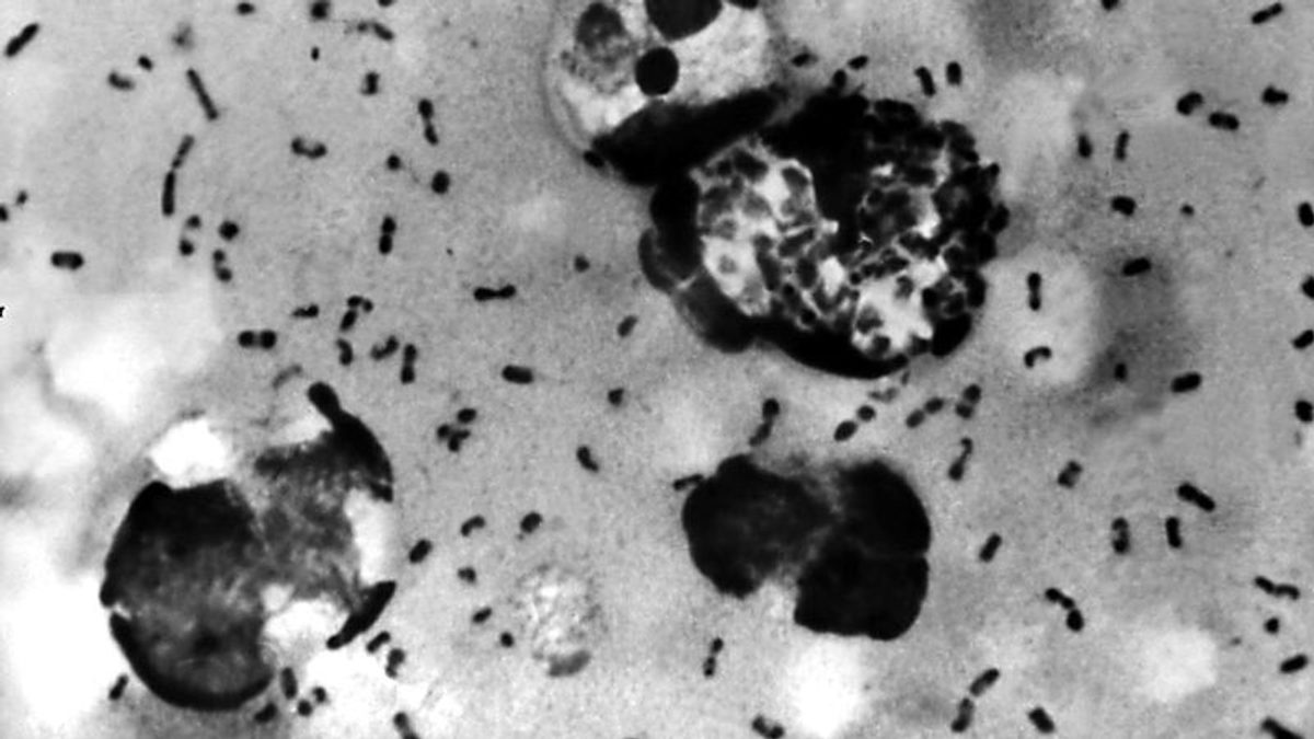 Peste neumónica en Ecuador: Análisis de riesgos sanitarios y contexto epidemiológico